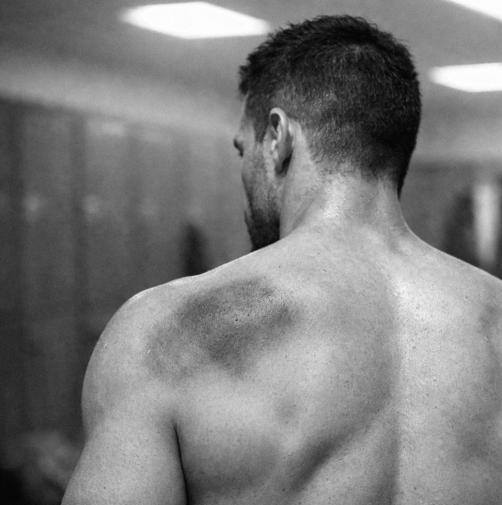 Weil ich lieber sterben würde